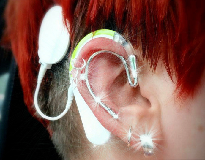 Bild Stäff Katzmann, Cochlea Implantat mit Schmuckbesatz